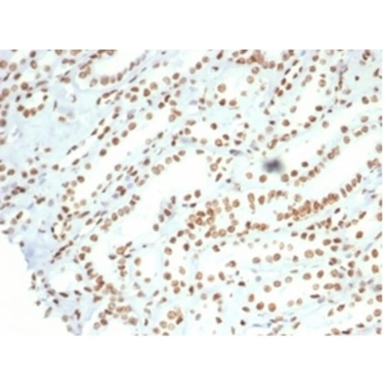 Immunohistochemistry - Anti-Nucleolin Antibody [NCL/7014R] - BSA and Azide free (A278625) - Antibodies.com