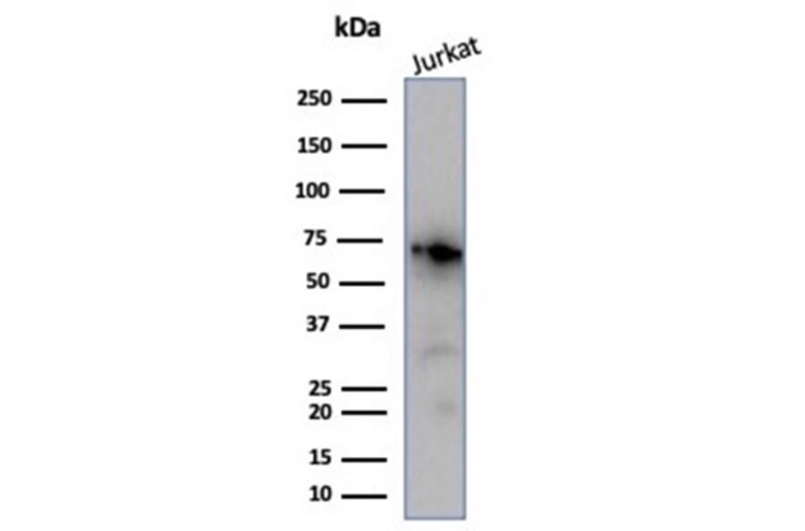 Western Blot - Anti-Nucleolin Antibody [NCL/7014R] - BSA and Azide free (A278625) - Antibodies.com