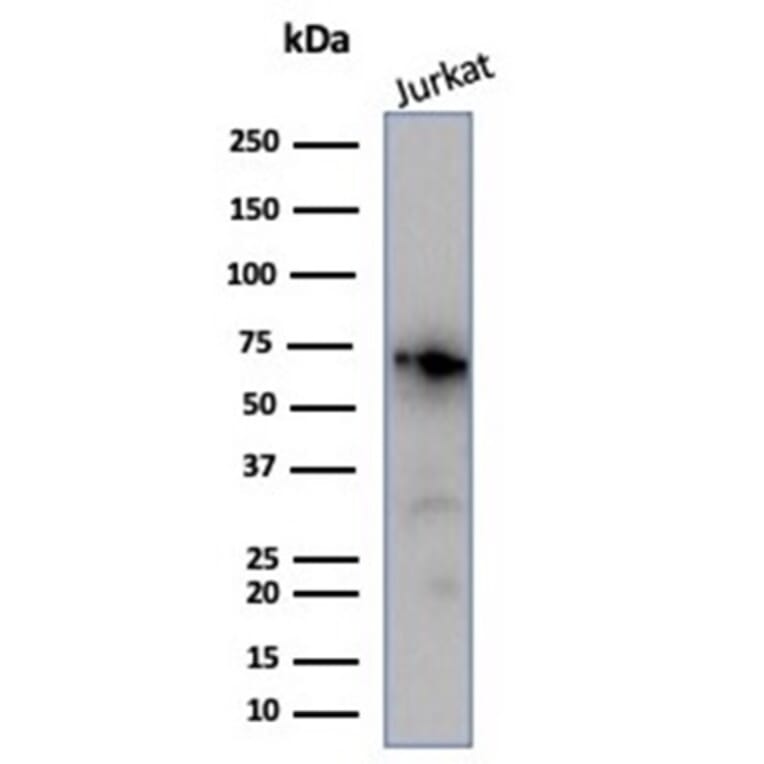 Western Blot - Anti-Nucleolin Antibody [NCL/7014R] - BSA and Azide free (A278625) - Antibodies.com
