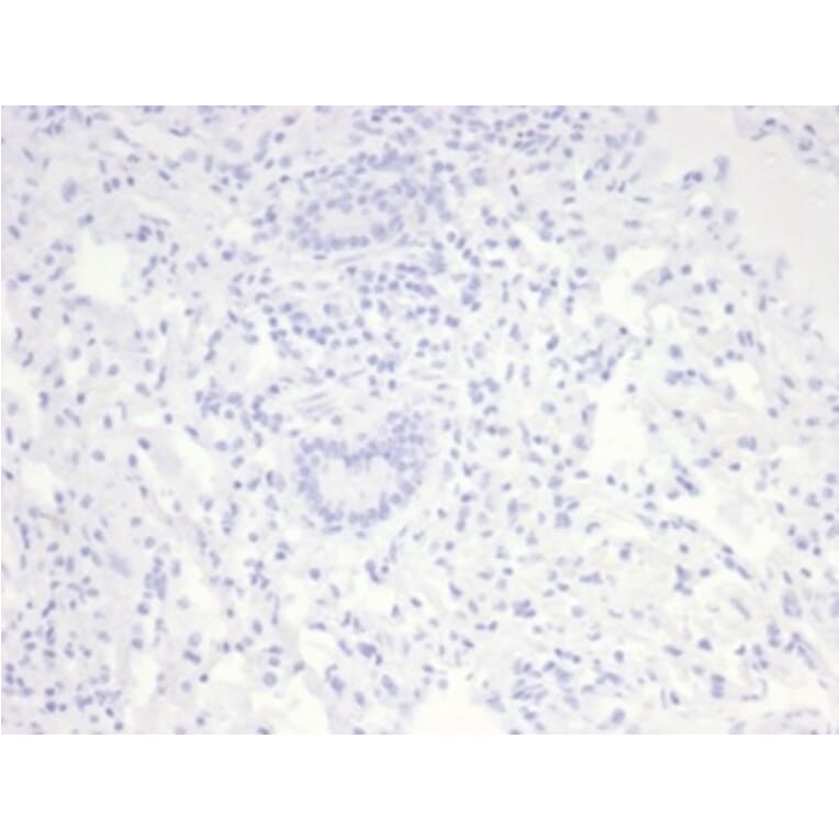 Immunohistochemistry - Anti-Nucleolin Antibody [NCL/7014R] - BSA and Azide free (A278625) - Antibodies.com