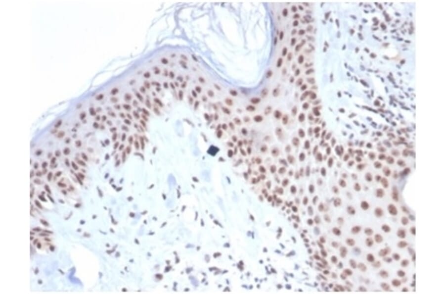Immunohistochemistry - Anti-Nucleophosmin Antibody [NPM1/7072R] - BSA and Azide free (A278626) - Antibodies.com