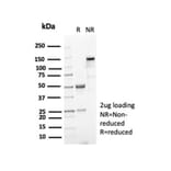 SDS-PAGE - Anti-Nucleophosmin Antibody [NPM1/7072R] - BSA and Azide free (A278626) - Antibodies.com