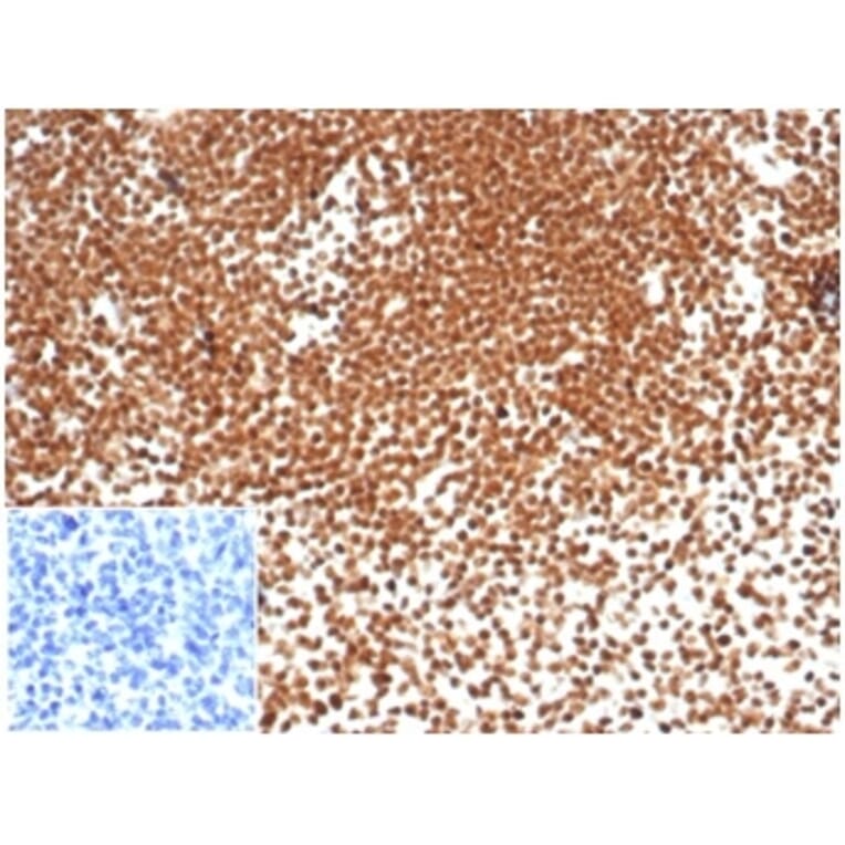 Immunohistochemistry - Anti-Nucleophosmin Antibody [NPM1/7072R] - BSA and Azide free (A278626) - Antibodies.com