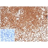 Immunohistochemistry - Anti-Nucleophosmin Antibody [NPM1/7072R] - BSA and Azide free (A278626) - Antibodies.com
