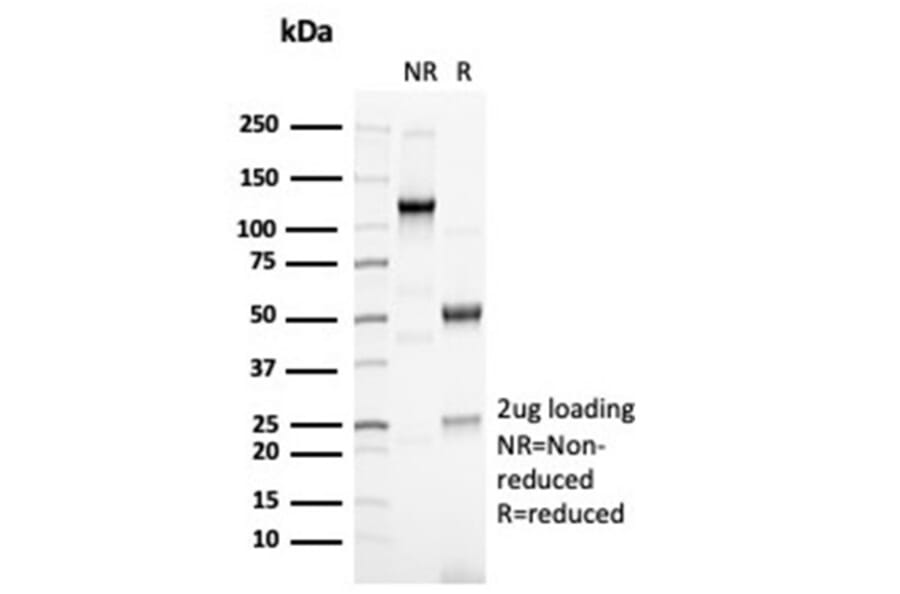 SDS-PAGE - Anti-PAX6 Antibody [PAX6/7078R] - BSA and Azide free (A278627) - Antibodies.com
