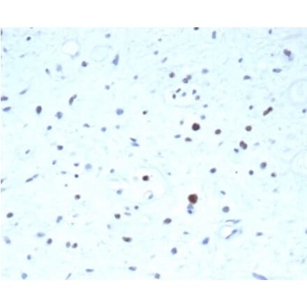 Immunohistochemistry - Anti-PAX7 Antibody [PAX7/7079R] - BSA and Azide free (A278628) - Antibodies.com