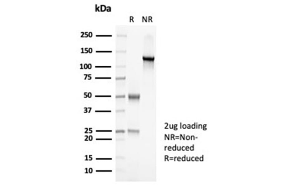 SDS-PAGE - Anti-PAX7 Antibody [PAX7/7079R] - BSA and Azide free (A278628) - Antibodies.com