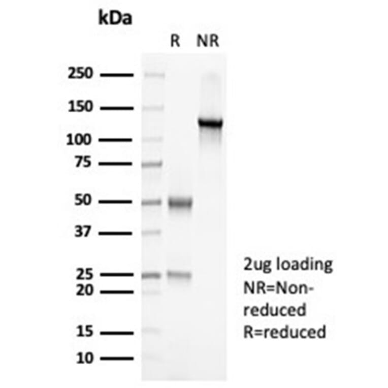 SDS-PAGE - Anti-PAX7 Antibody [PAX7/7079R] - BSA and Azide free (A278628) - Antibodies.com