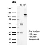 SDS-PAGE - Anti-PAX7 Antibody [PAX7/7079R] - BSA and Azide free (A278628) - Antibodies.com