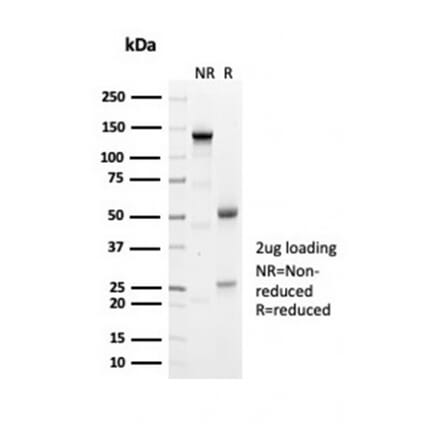 SDS-PAGE - Anti-Geminin Antibody [GMNN/7037R] - BSA and Azide free (A278629) - Antibodies.com