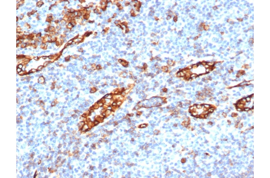 Immunohistochemistry - Anti-CD31 Antibody [C31/6446R] - BSA and Azide free (A278630) - Antibodies.com