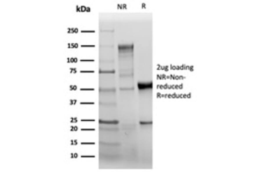 SDS-PAGE - Anti-CD31 Antibody [C31/6446R] - BSA and Azide free (A278630) - Antibodies.com