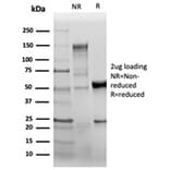 SDS-PAGE - Anti-CD31 Antibody [C31/6446R] - BSA and Azide free (A278630) - Antibodies.com