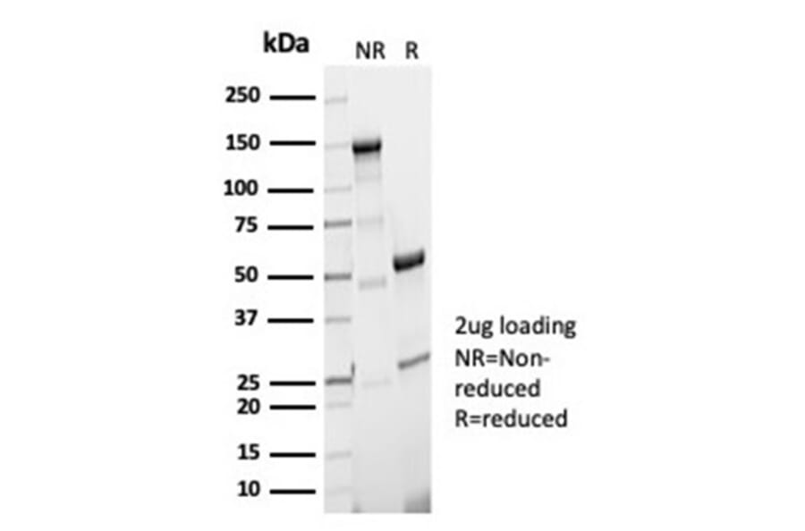 SDS-PAGE - Anti-Phosphoglucomutase 5 Antibody [PGM5/7005R] - BSA and Azide free (A278631) - Antibodies.com