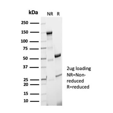 SDS-PAGE - Anti-Phosphoglucomutase 5 Antibody [PGM5/7005R] - BSA and Azide free (A278631) - Antibodies.com