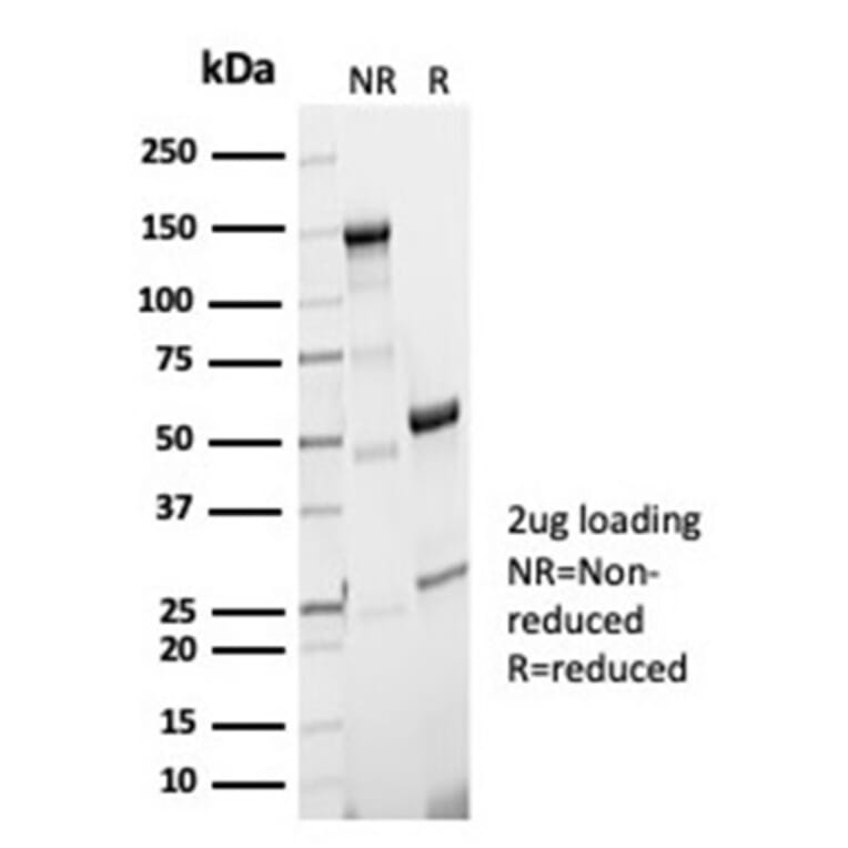 SDS-PAGE - Anti-Phosphoglucomutase 5 Antibody [PGM5/7005R] - BSA and Azide free (A278631) - Antibodies.com