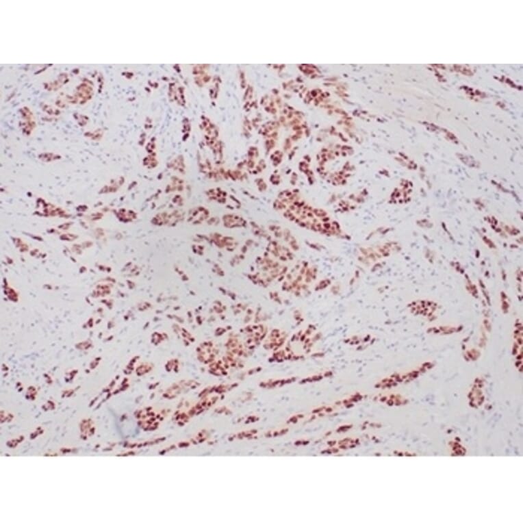 Immunohistochemistry - Anti-Progesterone Receptor Antibody [PGR/6854R] - BSA and Azide free (A278632) - Antibodies.com