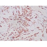 Immunohistochemistry - Anti-Progesterone Receptor Antibody [PGR/6854R] - BSA and Azide free (A278632) - Antibodies.com