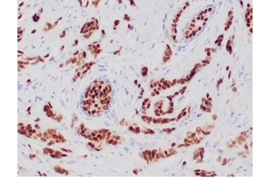 Immunohistochemistry - Anti-Progesterone Receptor Antibody [PGR/6854R] - BSA and Azide free (A278632) - Antibodies.com