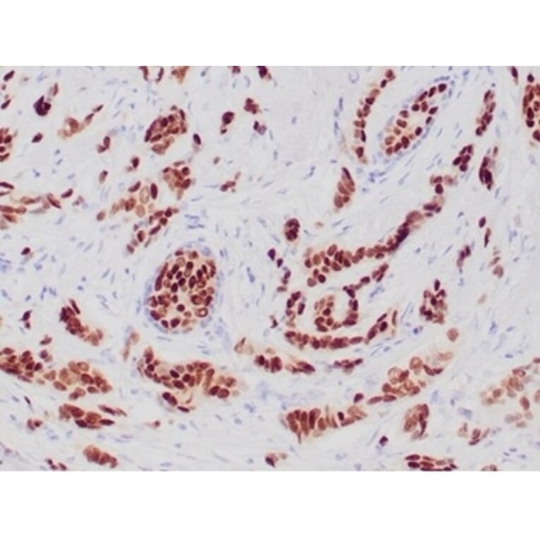 Immunohistochemistry - Anti-Progesterone Receptor Antibody [PGR/6854R] - BSA and Azide free (A278632) - Antibodies.com