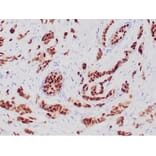 Immunohistochemistry - Anti-Progesterone Receptor Antibody [PGR/6854R] - BSA and Azide free (A278632) - Antibodies.com