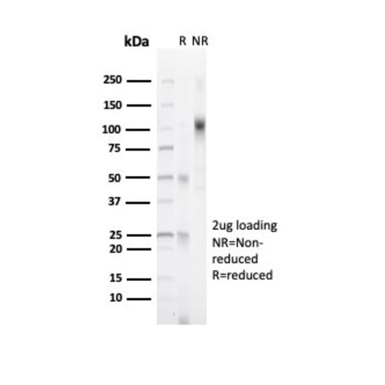 SDS-PAGE - Anti-Progesterone Receptor Antibody [PGR/6854R] - BSA and Azide free (A278632) - Antibodies.com