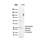 SDS-PAGE - Anti-Progesterone Receptor Antibody [PGR/6854R] - BSA and Azide free (A278632) - Antibodies.com