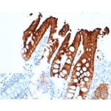 Immunohistochemistry - Anti-Cytokeratin 20 Antibody [KRT20/4879R] - BSA and Azide free (A278634) - Antibodies.com