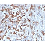 Immunohistochemistry - Anti-Cytokeratin 20 Antibody [KRT20/4879R] - BSA and Azide free (A278634) - Antibodies.com