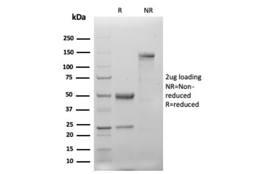 SDS-PAGE - Anti-Cytokeratin 20 Antibody [KRT20/4879R] - BSA and Azide free (A278634) - Antibodies.com