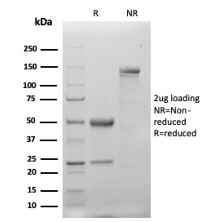 SDS-PAGE - Anti-Cytokeratin 20 Antibody [KRT20/4879R] - BSA and Azide free (A278634) - Antibodies.com