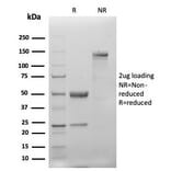 SDS-PAGE - Anti-Cytokeratin 20 Antibody [KRT20/4879R] - BSA and Azide free (A278634) - Antibodies.com