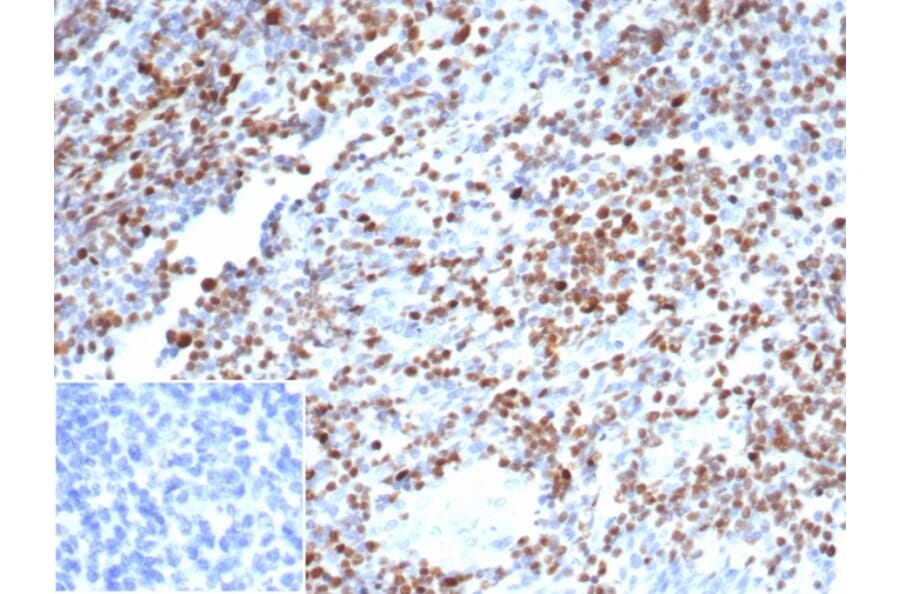 Immunohistochemistry - Anti-OCT-2 Antibody [OCT2/7073R] - BSA and Azide free (A278635) - Antibodies.com