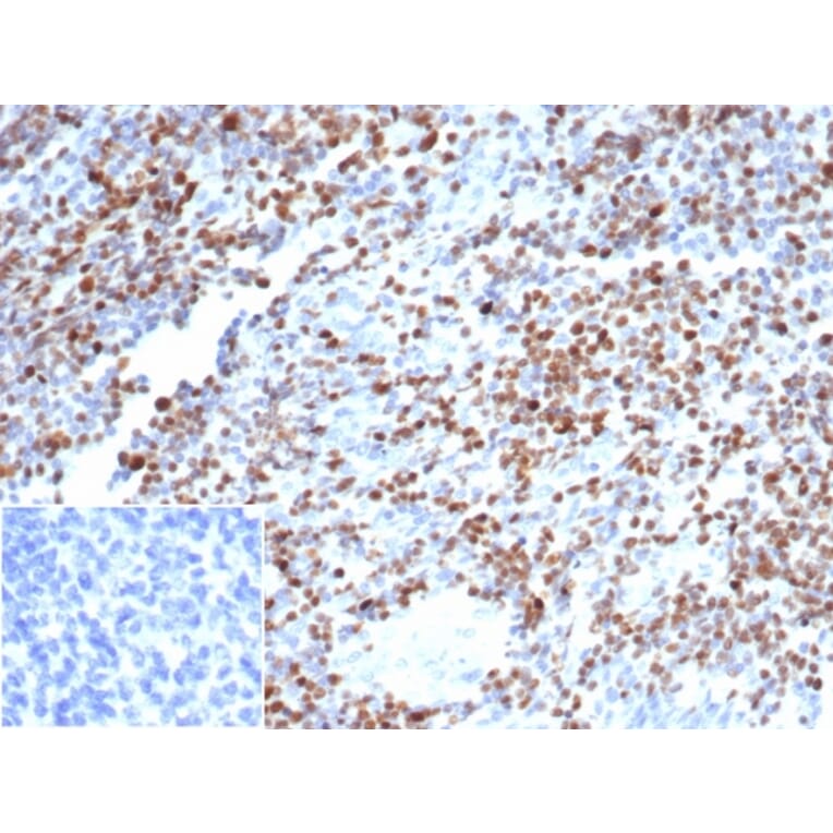 Immunohistochemistry - Anti-OCT-2 Antibody [OCT2/7073R] - BSA and Azide free (A278635) - Antibodies.com