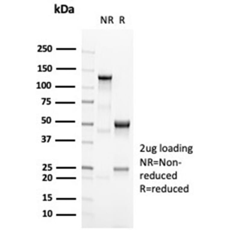 SDS-PAGE - Anti-OCT-2 Antibody [OCT2/7073R] - BSA and Azide free (A278635) - Antibodies.com