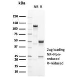 SDS-PAGE - Anti-OCT-2 Antibody [OCT2/7073R] - BSA and Azide free (A278635) - Antibodies.com
