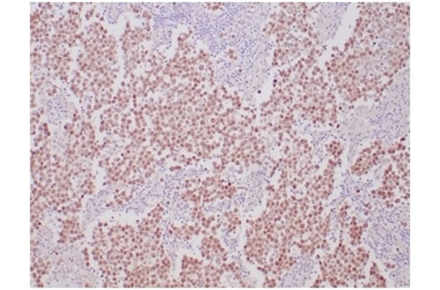 Immunohistochemistry - Anti-OCT-4 Antibody [OCT4/6875R] - BSA and Azide free (A278636) - Antibodies.com
