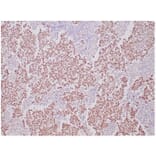 Immunohistochemistry - Anti-OCT-4 Antibody [OCT4/6875R] - BSA and Azide free (A278636) - Antibodies.com
