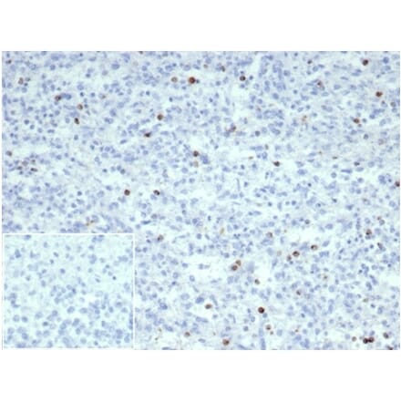 Immunohistochemistry - Anti-Perforin Antibody [PRF1/7077R] - BSA and Azide free (A278637) - Antibodies.com