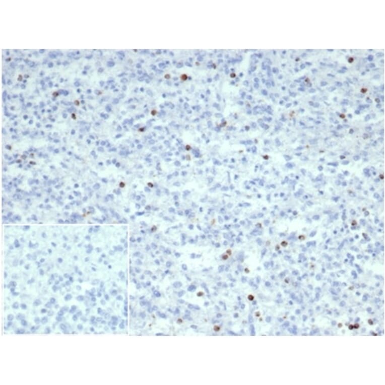 Immunohistochemistry - Anti-Perforin Antibody [PRF1/7077R] - BSA and Azide free (A278637) - Antibodies.com
