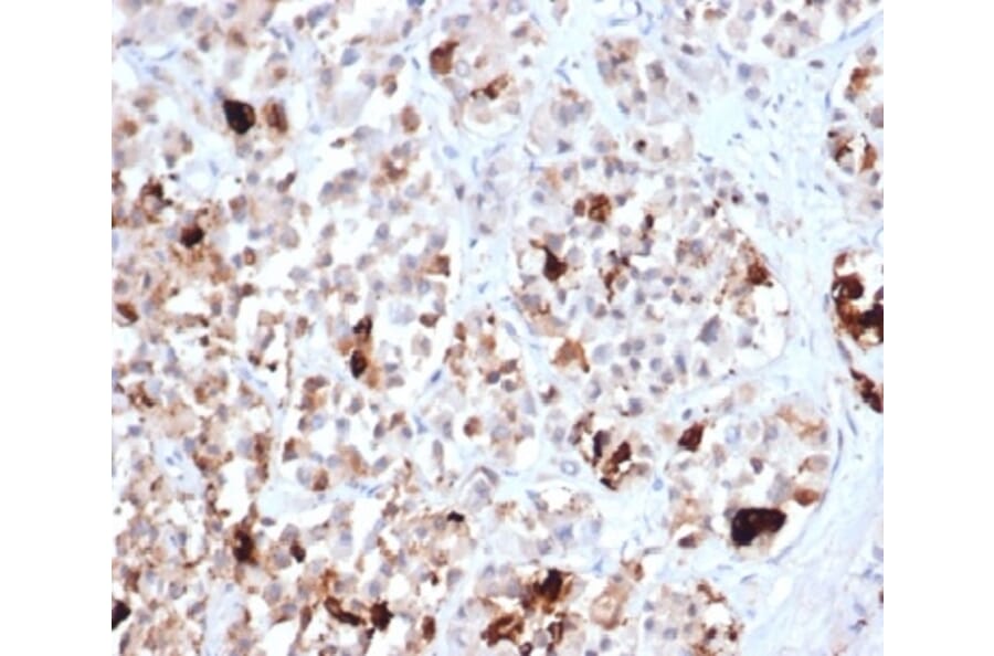 Immunohistochemistry - Anti-Prolactin Antibody [PRL/4906R] - BSA and Azide free (A278638) - Antibodies.com