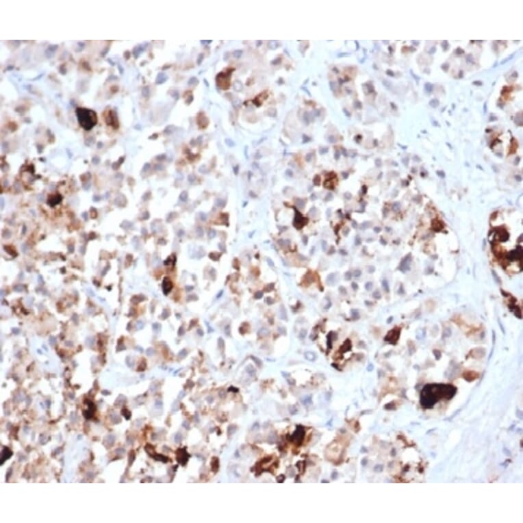 Immunohistochemistry - Anti-Prolactin Antibody [PRL/4906R] - BSA and Azide free (A278638) - Antibodies.com