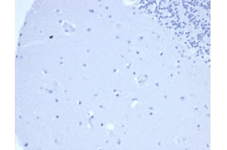 Immunohistochemistry - Anti-Prolactin Antibody [PRL/4906R] - BSA and Azide free (A278638) - Antibodies.com