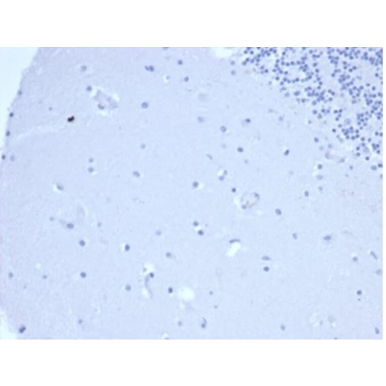 Immunohistochemistry - Anti-Prolactin Antibody [PRL/4906R] - BSA and Azide free (A278638) - Antibodies.com