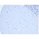 Immunohistochemistry - Anti-Prolactin Antibody [PRL/4906R] - BSA and Azide free (A278638) - Antibodies.com