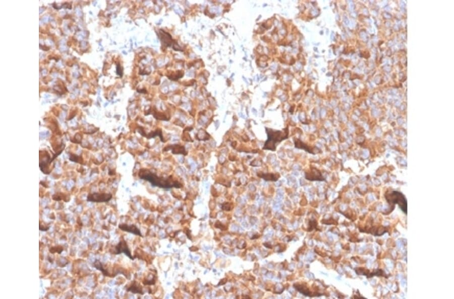 Immunohistochemistry - Anti-Prolactin Antibody [PRL/4906R] - BSA and Azide free (A278638) - Antibodies.com