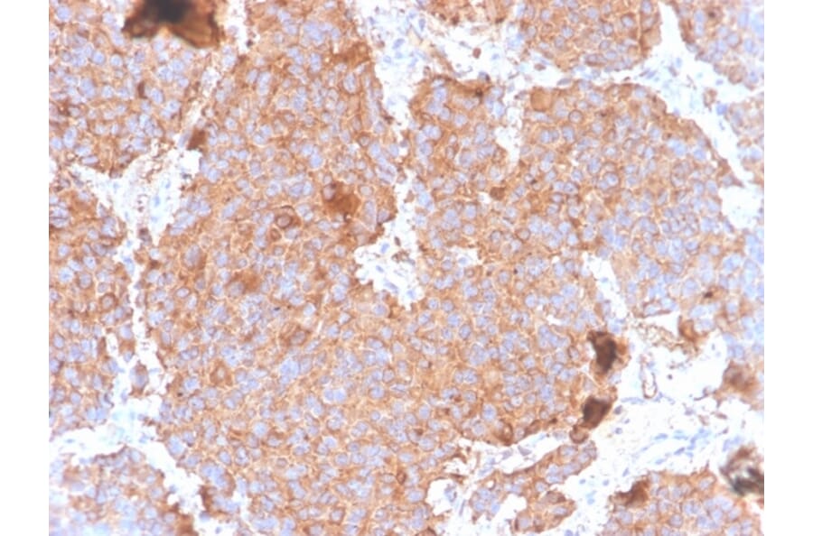 Immunohistochemistry - Anti-Prolactin Antibody [PRL/4908R] - BSA and Azide free (A278639) - Antibodies.com