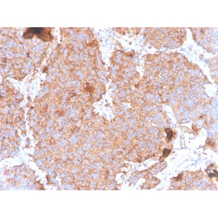 Immunohistochemistry - Anti-Prolactin Antibody [PRL/4908R] - BSA and Azide free (A278639) - Antibodies.com