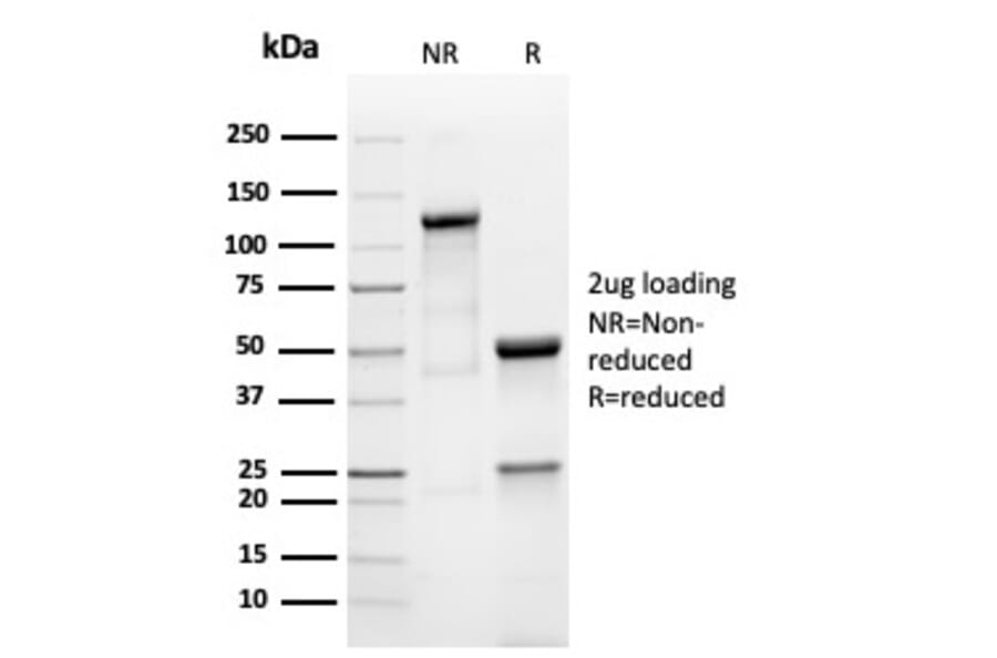 SDS-PAGE - Anti-Prolactin Antibody [PRL/4908R] - BSA and Azide free (A278639) - Antibodies.com