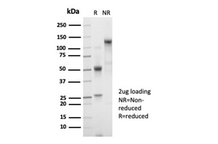 SDS-PAGE - Anti-beta 2 Microglobulin Antibody [B2M/7013R] - BSA and Azide free (A278640) - Antibodies.com
